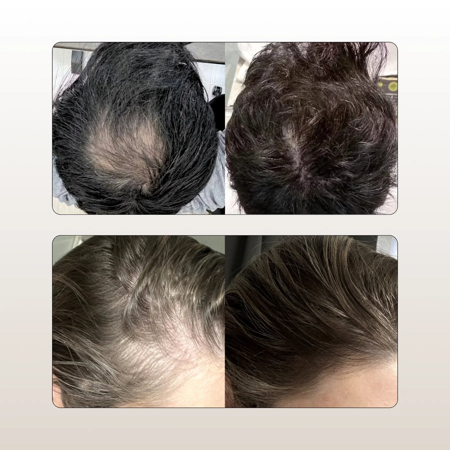 Shampoo Disaar ® 2x1